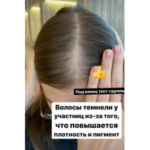 Волосы - выпадения и алопеции. Елена Корнилова Волосы - выпадения и алопеции. Елена Корнилова