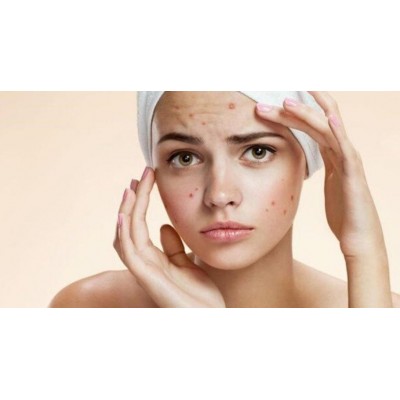  Акне. Здоровая кожа. Елена Корнилова