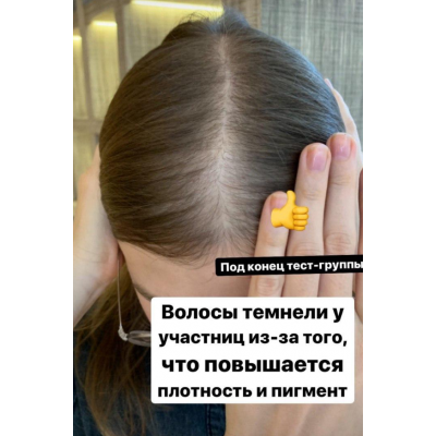 Волосы - выпадения и алопеции. Елена Корнилова