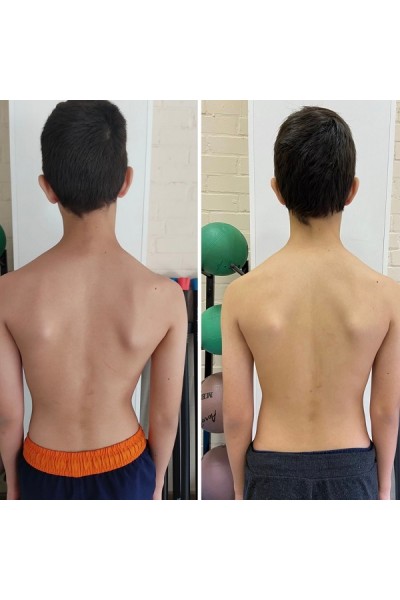 Гимнастика для здоровой спины Айкуне. Aikune_rostov