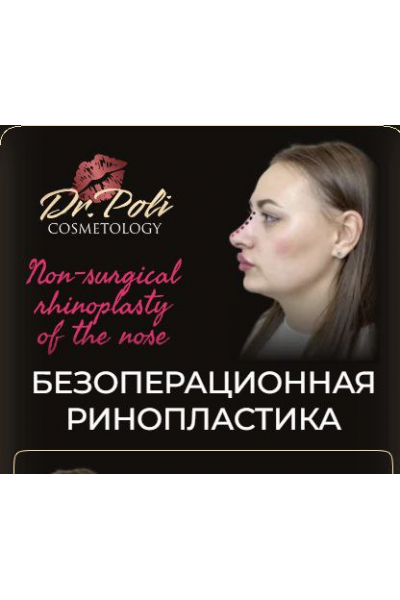 Безоперационная ринопластика. Полина Еремина dr.poli