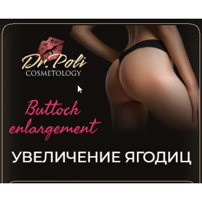 Увеличение ягодиц. Полина Еремина dr.poli