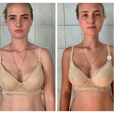 Восстановление молодости лица. 2.0. Вера Красивая