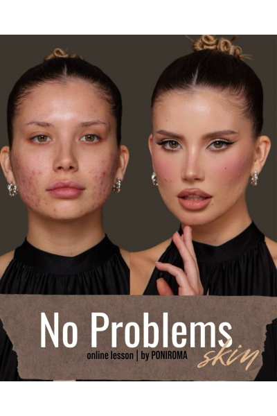 No problems. by poniroma