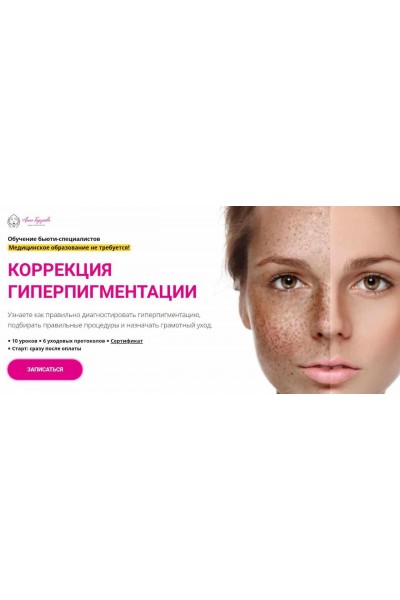 Коррекция гиперпигментации. Анна Гордеева, Edcosmetology