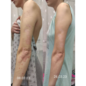 Легендарный прочистон. Алена Ковальчук