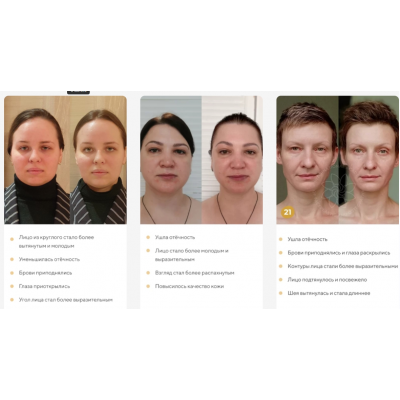 Отекам Нет. Январь 2022. Алесь Улищенко  Международная Академия фейспластики и остеопатии