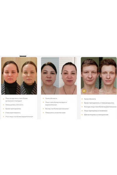 Отекам Нет. Январь 2022. Алесь Улищенко  Международная Академия фейспластики и остеопатии