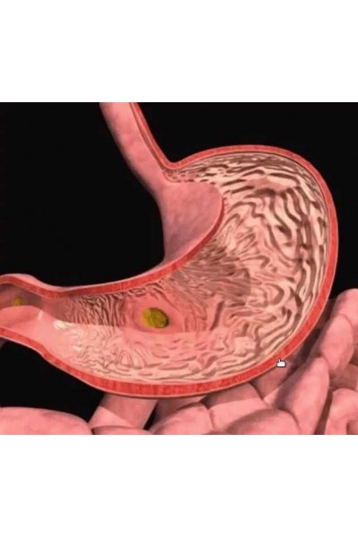 Избавься от гастрита и язвы, не вставая со стула. Виктор Луганский